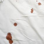 bed bug bites blood on sheets
